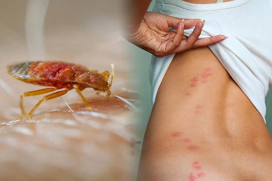 Bed Bugs Control in Dhaka